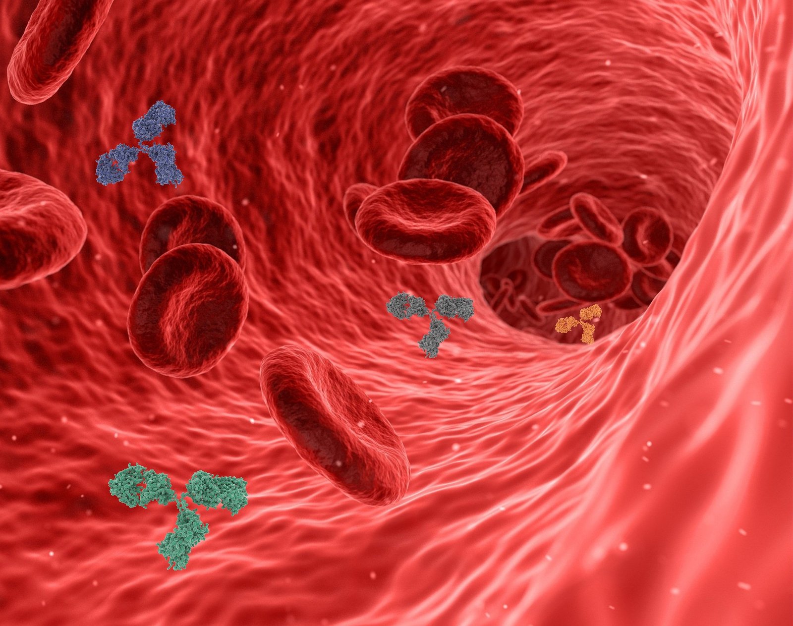 缺铁性贫血就是由于体内缺少铁质而影响血红蛋白合成所引起的贫血。血液